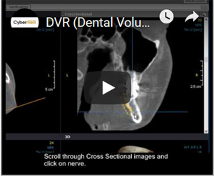 Link to YouTube Video - OnDemand3D Video Manual  DVR (Dental Volume Reformat) Module - Draw Nerve
