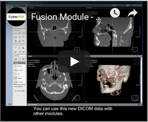 Link to YouTube Video - OnDemand 3D Video Fusion Module - Secondary only / Merged / Subtraction / Maximum