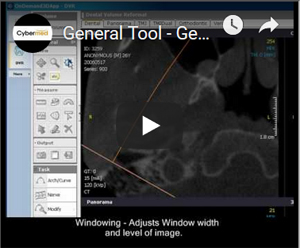 Link to YouTube Video - OnDemand3D Video Manual  General Tool - General View (Zoom,Pan,Invert)